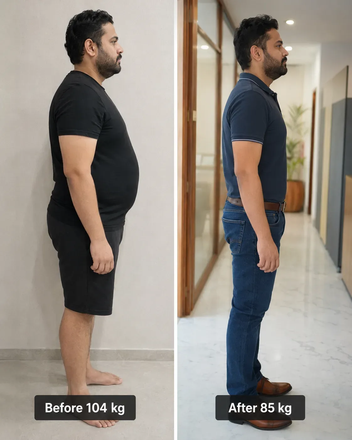 Weight Management